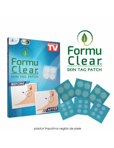 FormuClear Skin Tag Patch - plasturi impotriva negilor de piele skit30L